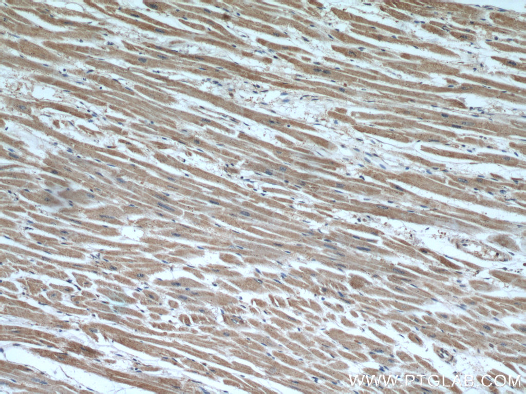 IHC staining of human heart using 20892-1-AP