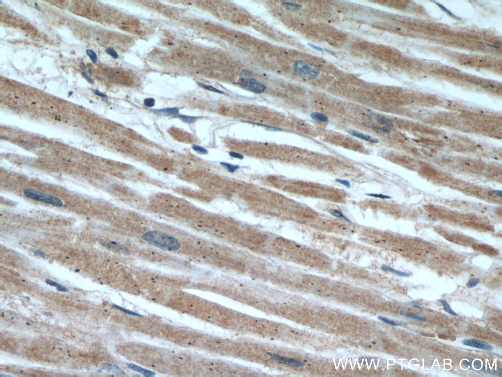 IHC staining of human heart using 20892-1-AP