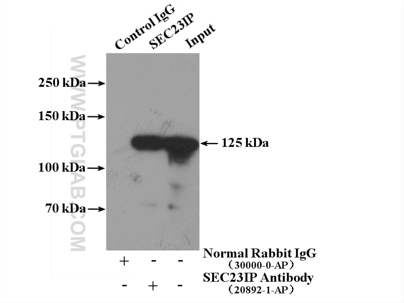 IP experiment of HeLa using 20892-1-AP