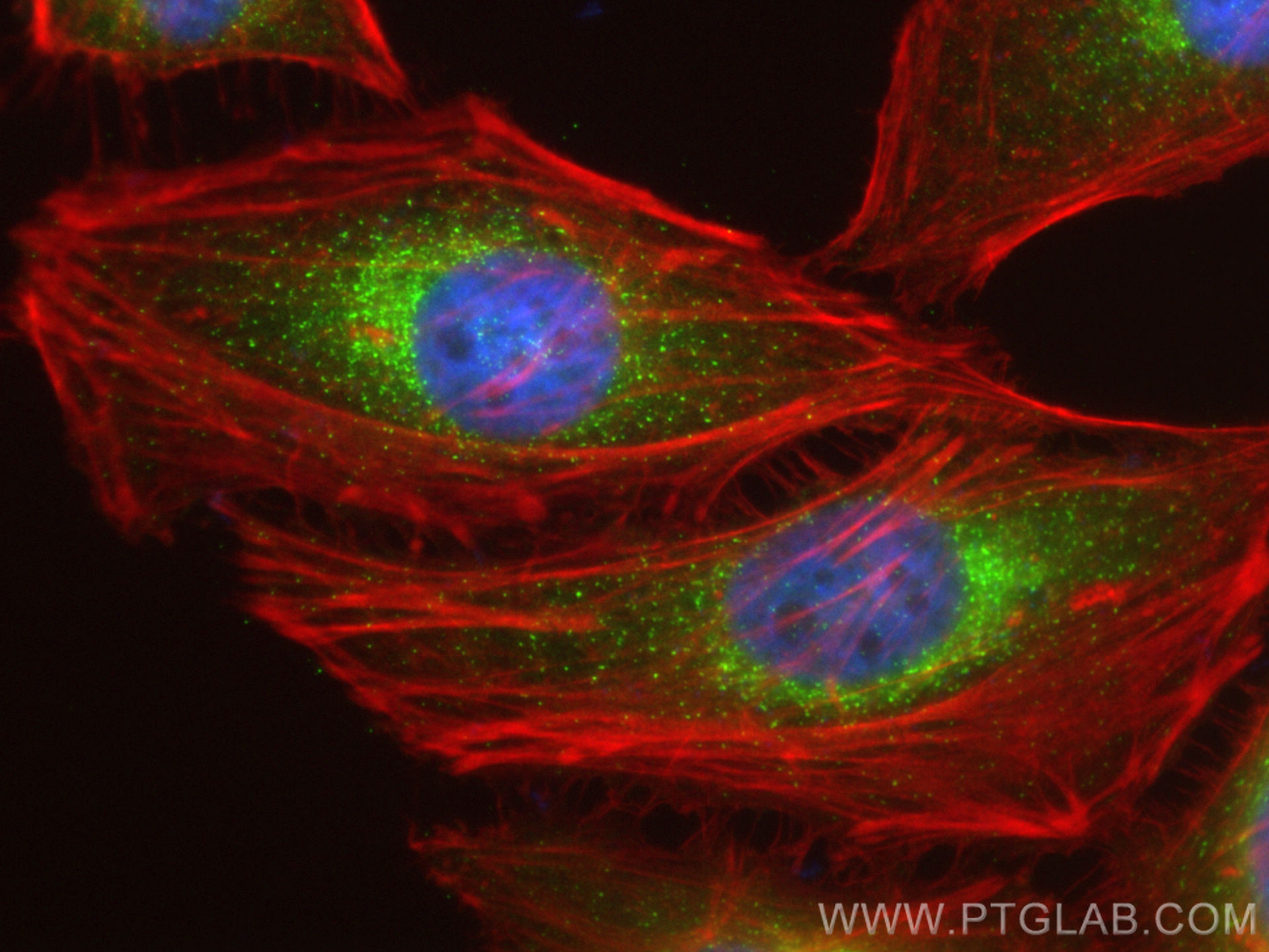 IF Staining of HeLa using 17913-1-AP