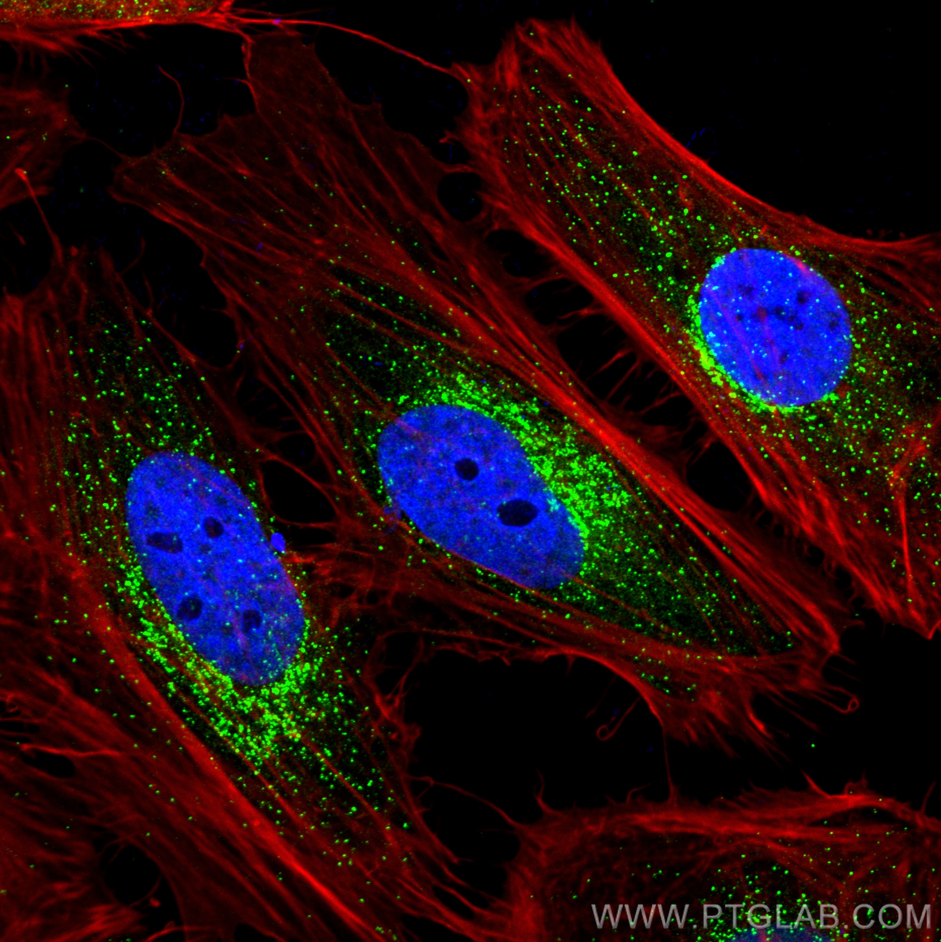 IF Staining of HeLa using 17913-1-AP