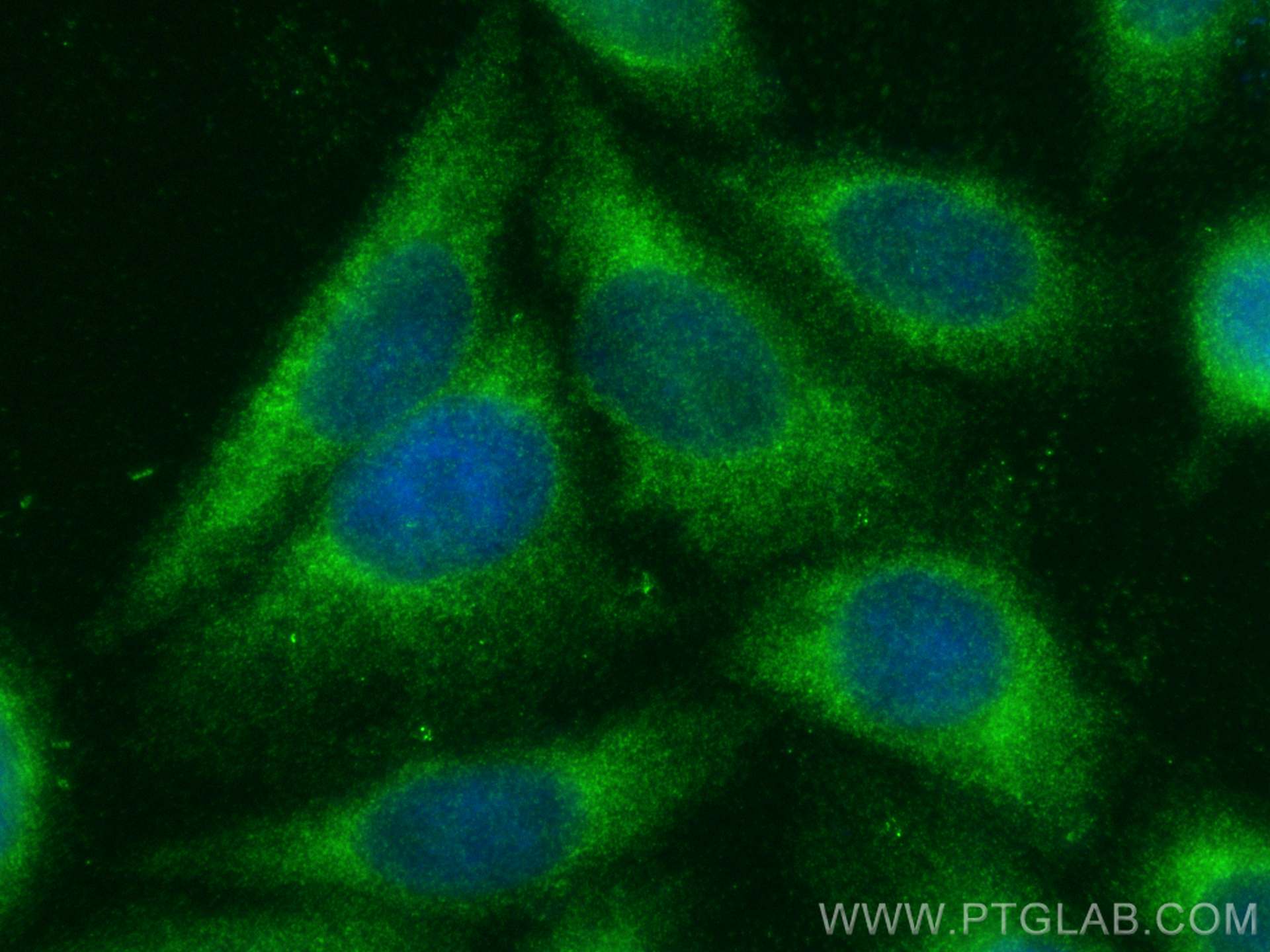 IF Staining of HepG2 using 15087-1-AP