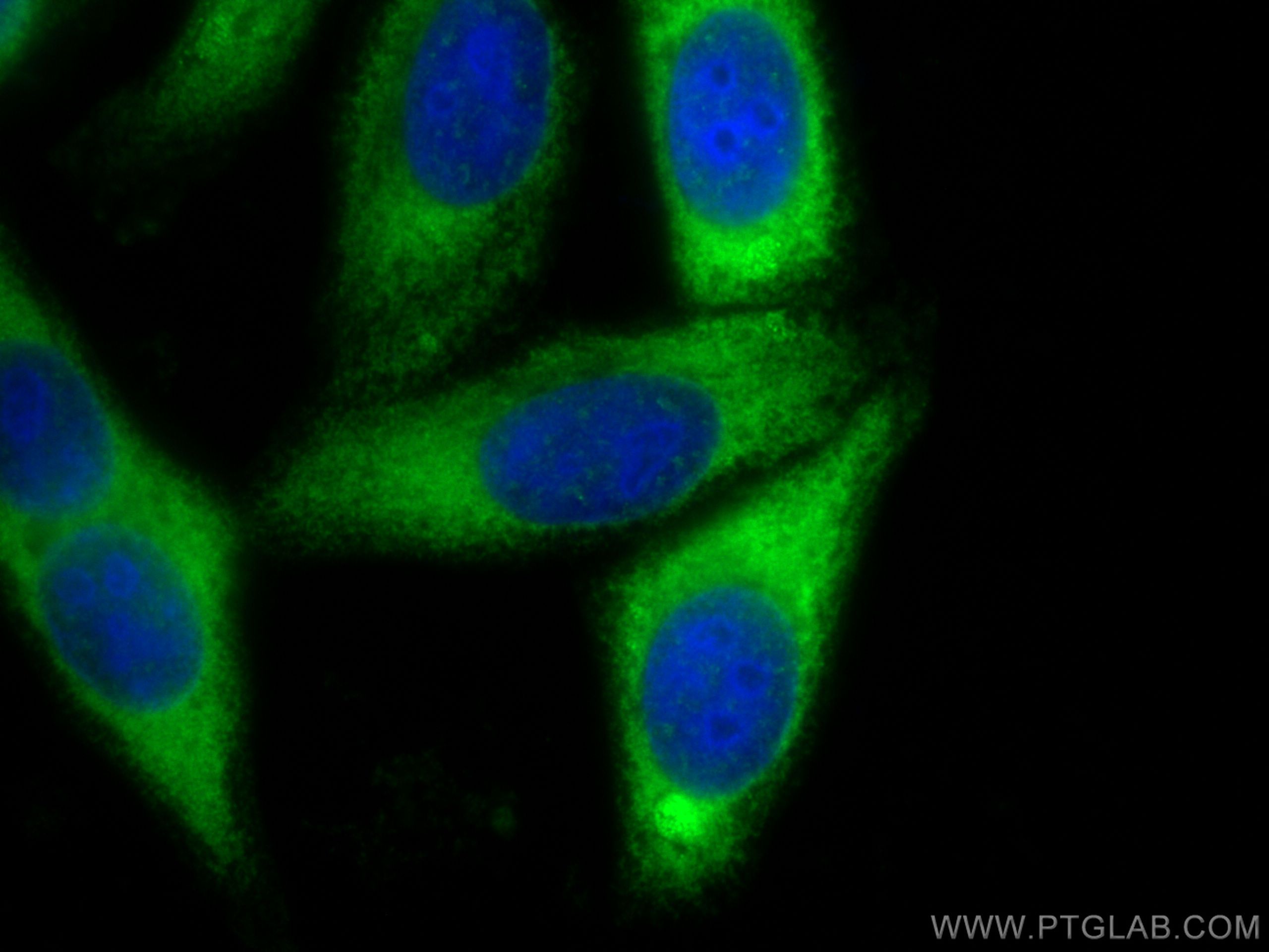 IF Staining of HepG2 using 28693-1-AP