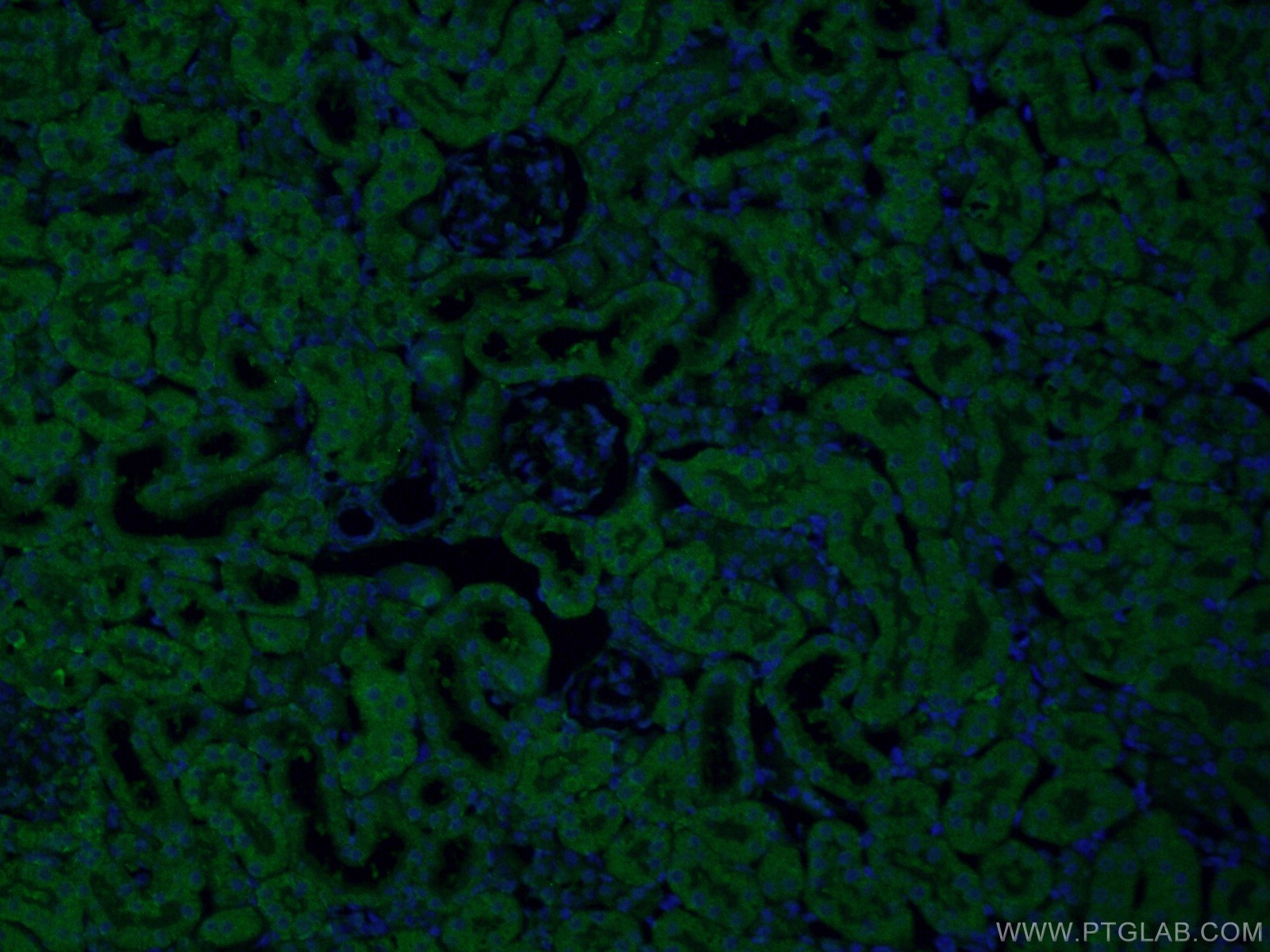 IF Staining of mouse kidney using 13978-1-AP