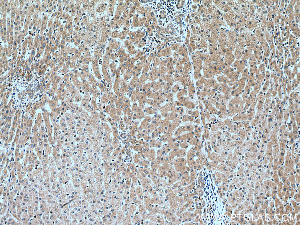 IHC staining of human liver using 13978-1-AP