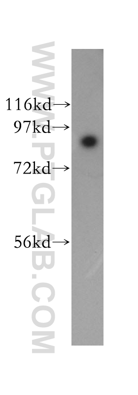 WB analysis of A431 using 13978-1-AP