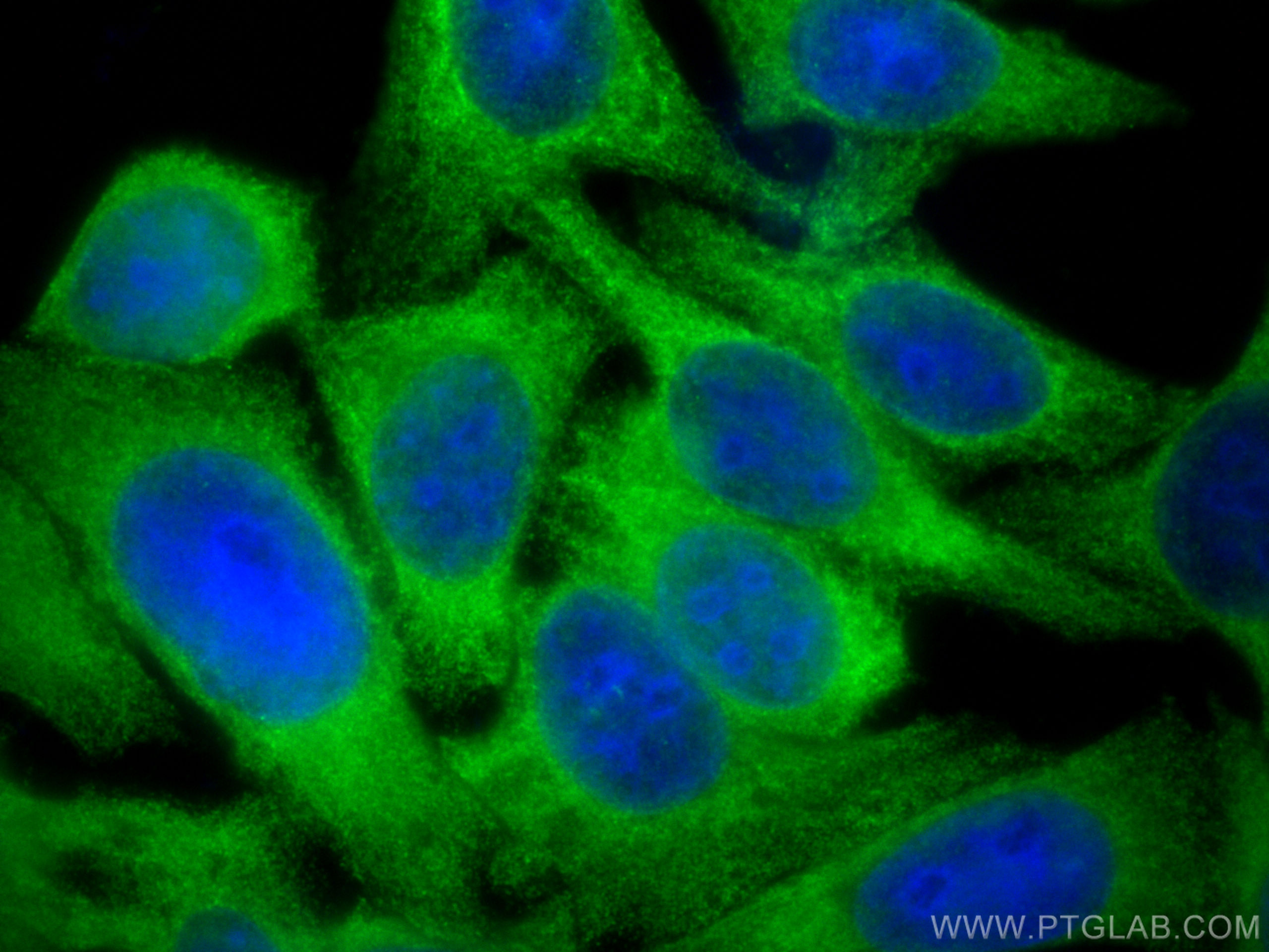 IF Staining of HepG2 using 12798-1-AP