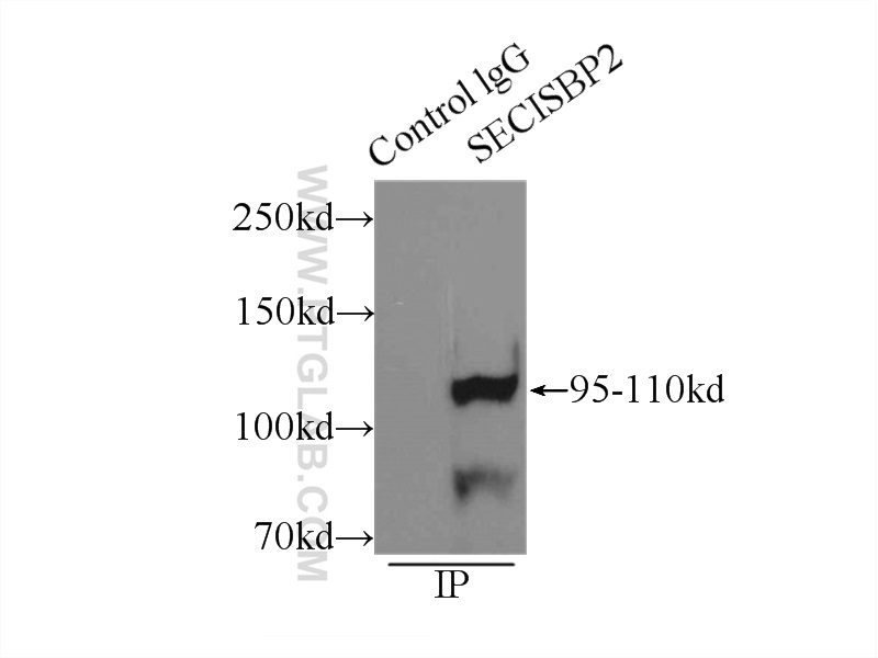 IP experiment of mouse testis using 12798-1-AP