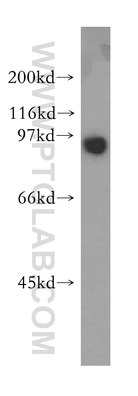 WB analysis of HeLa using 12798-1-AP