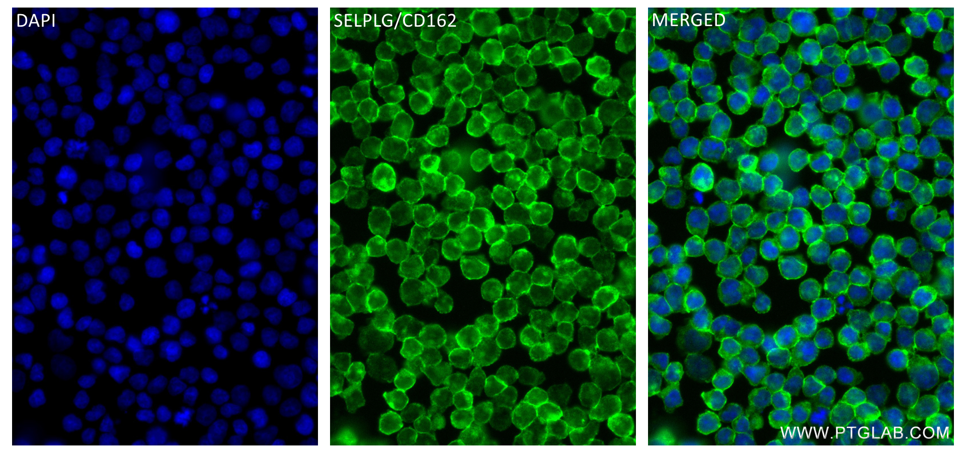 IF Staining of Jurkat using 84500-1-RR (same clone as 84500-1-PBS)