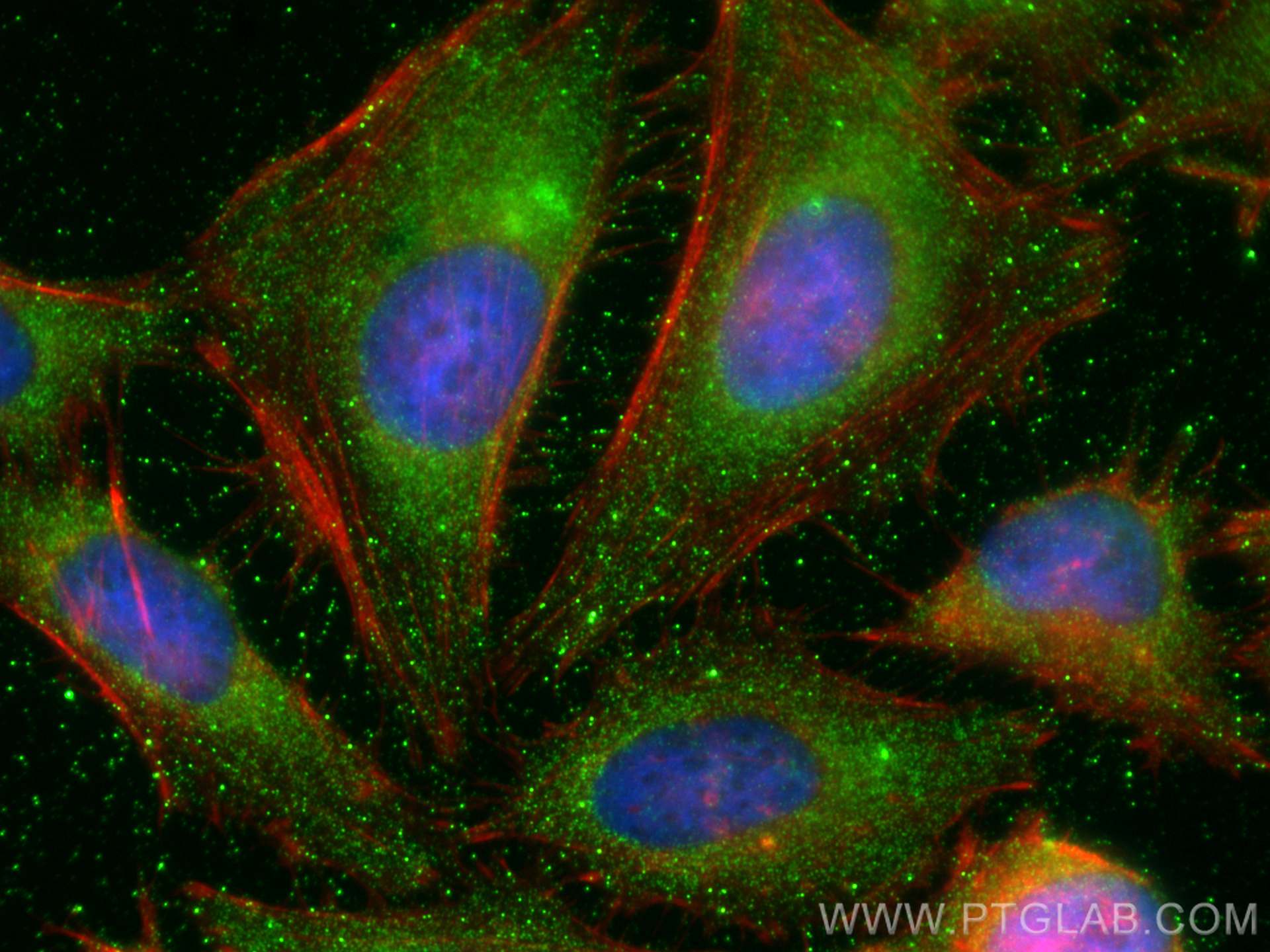 IF Staining of HeLa using 27836-1-AP