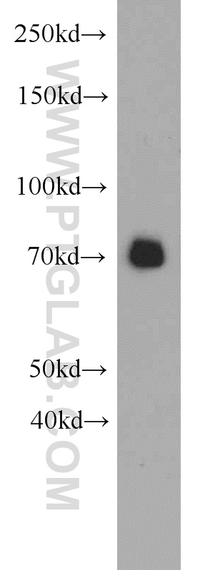 WB analysis of mouse heart using 19242-1-AP