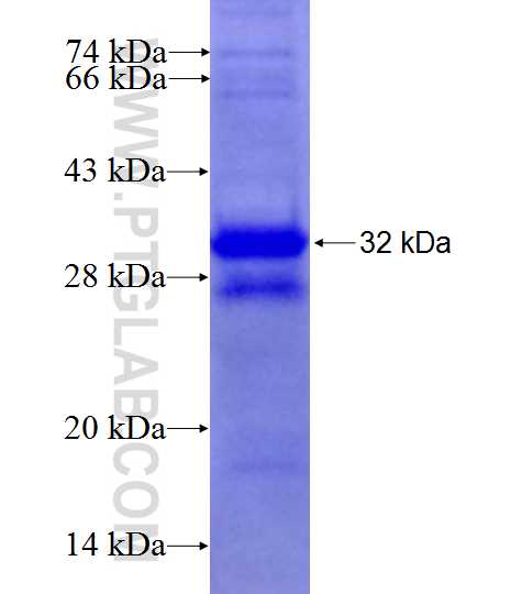 SEMA5B fusion protein Ag27498 SDS-PAGE