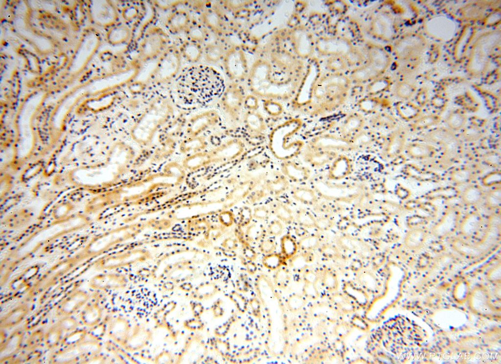 IHC staining of human kidney using 15916-1-AP