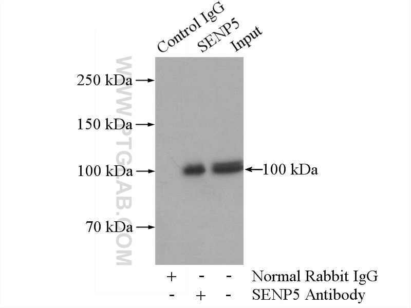 IP experiment of HeLa using 19529-1-AP