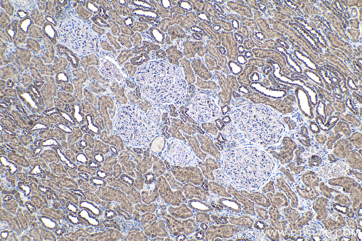 IHC staining of human kidney using 13479-1-AP