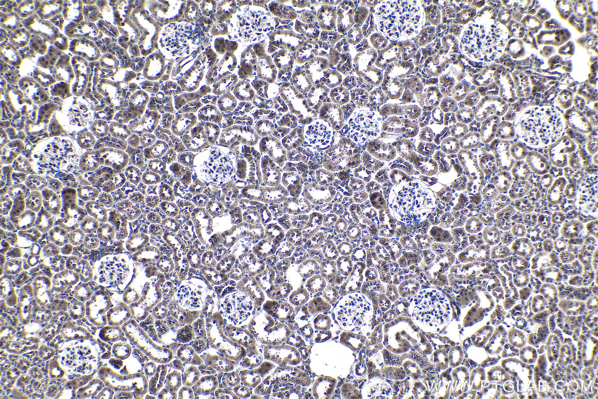 IHC staining of rat kidney using 13479-1-AP