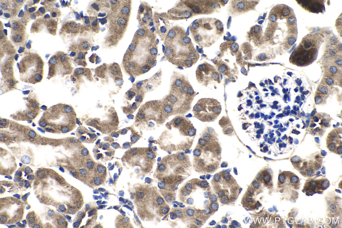 IHC staining of mouse kidney using 13479-1-AP