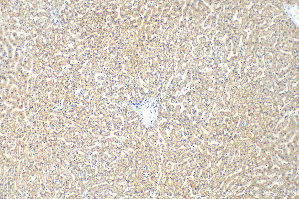 IHC staining of human liver using 13479-1-AP