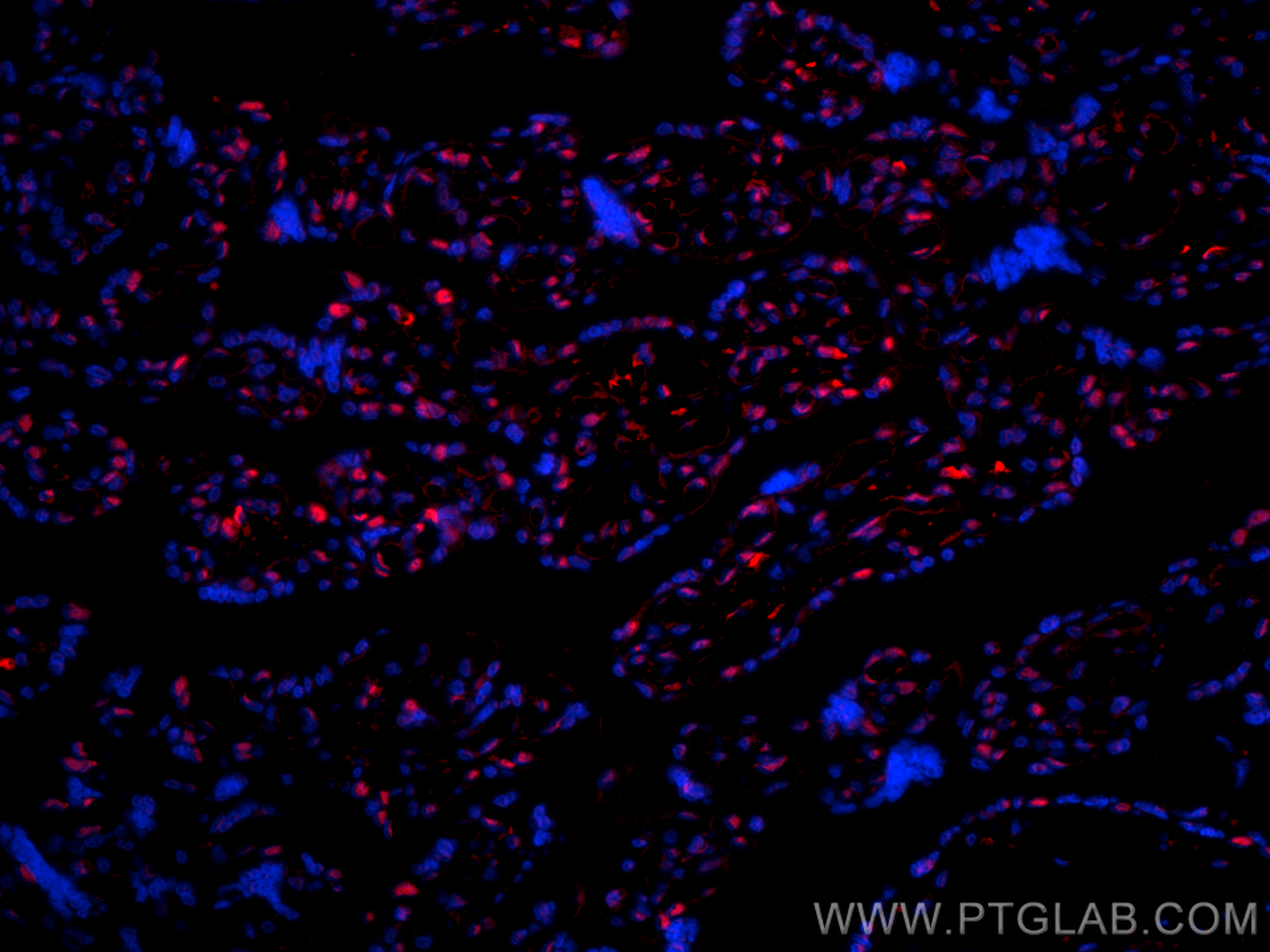 IF Staining of human placenta using 16635-1-AP