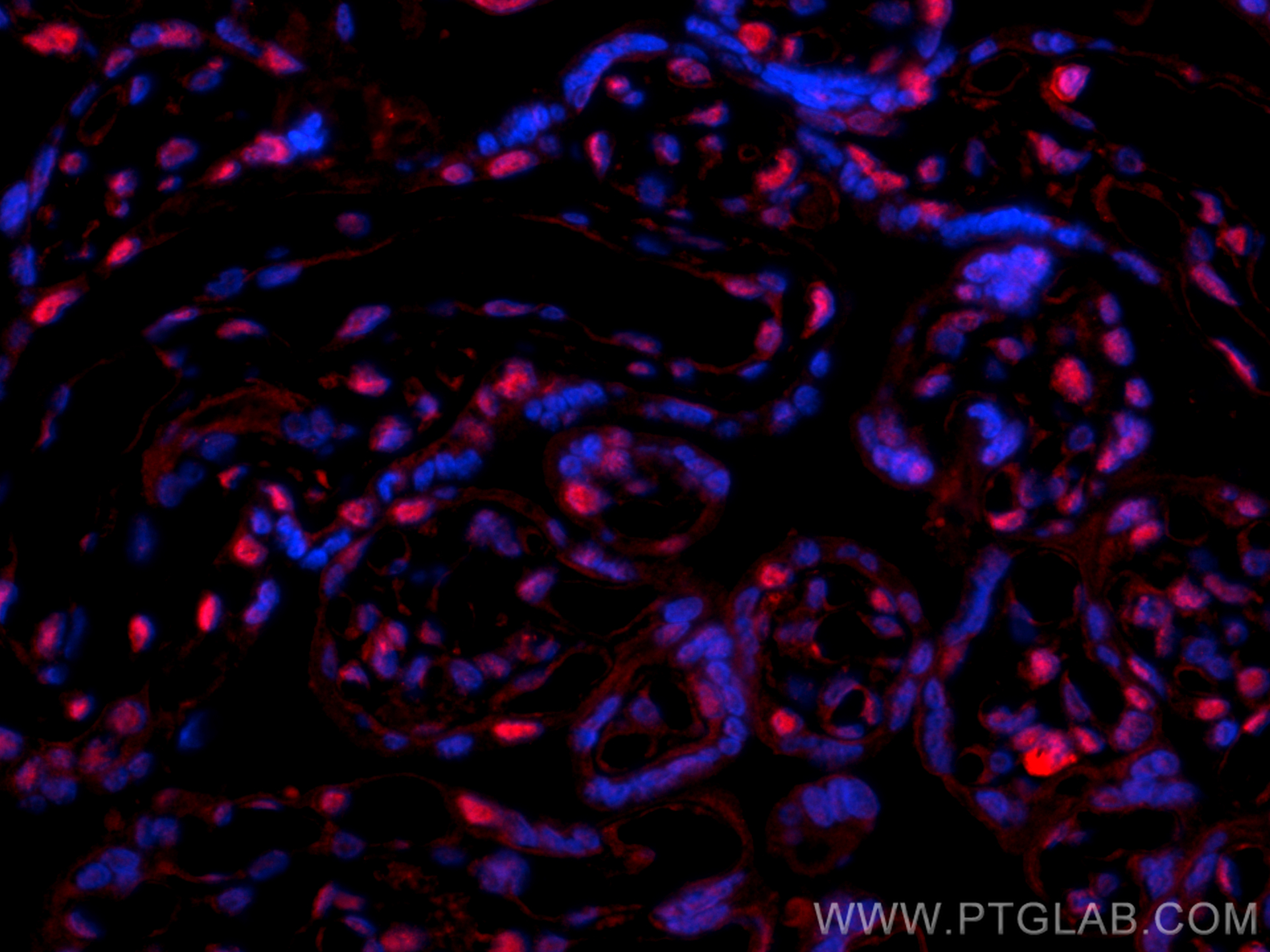 IF Staining of human placenta using 16635-1-AP