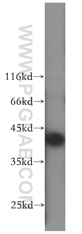 WB analysis of HepG2 using 16635-1-AP