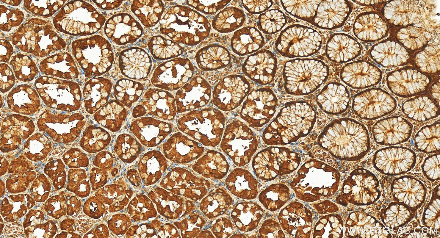 IHC staining of human stomach using 11551-1-AP