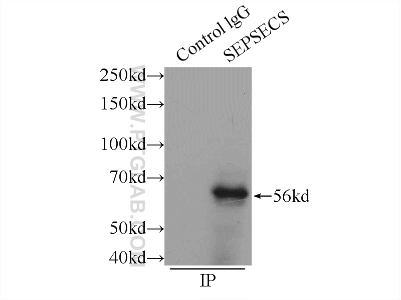 IP experiment of mouse liver using 11551-1-AP