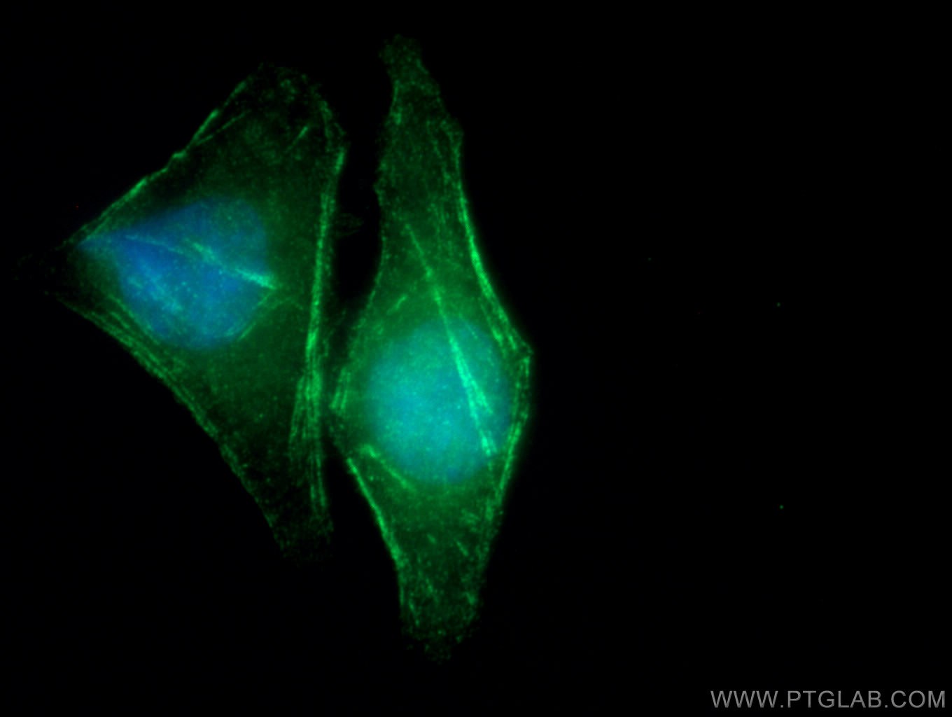 IF Staining of HepG2 using 12420-1-AP