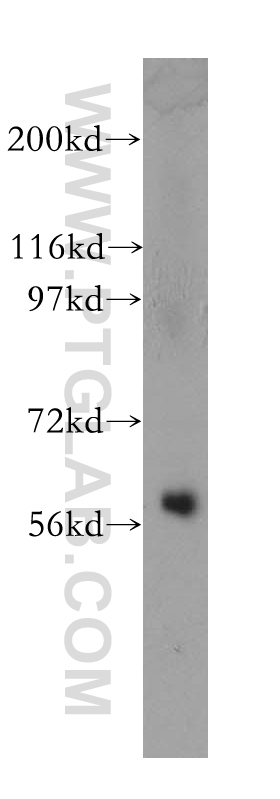 WB analysis of human kidney using 12420-1-AP