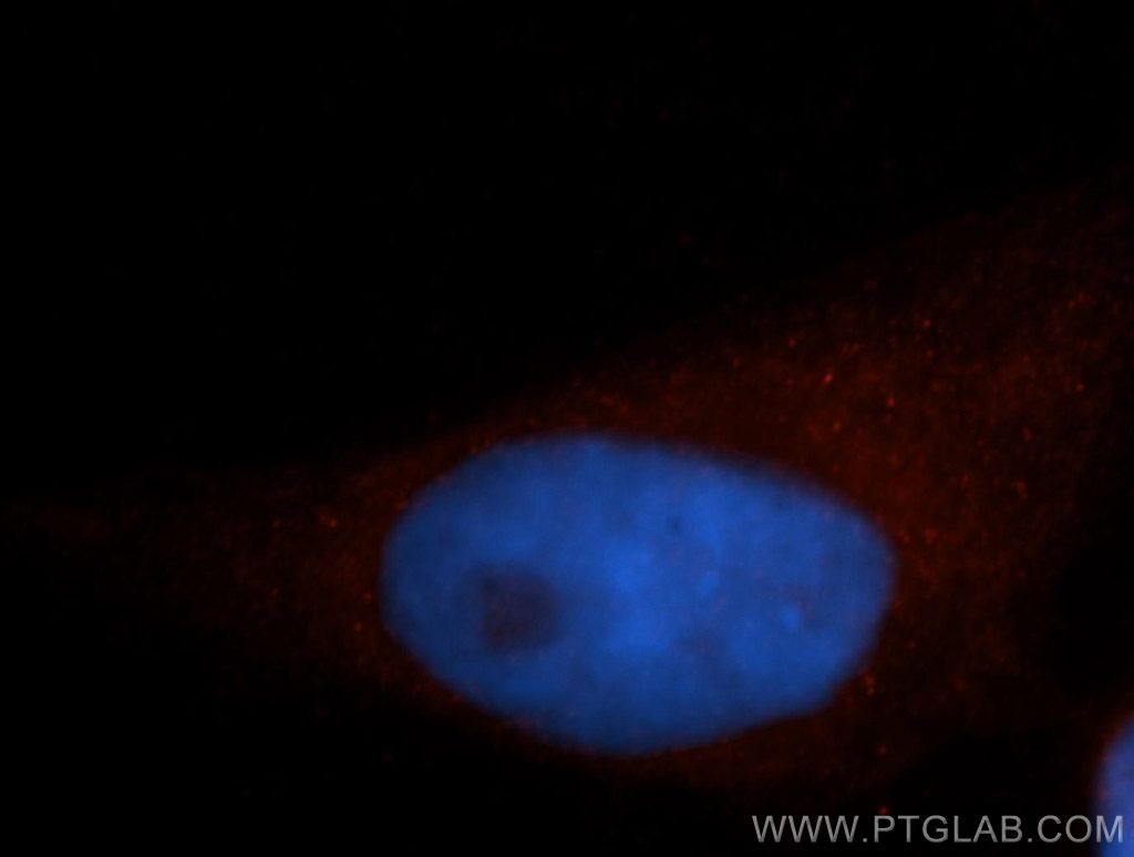 IF Staining of HeLa using 14672-1-AP