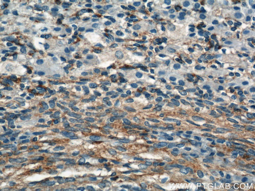 IHC staining of human ovary using 14672-1-AP