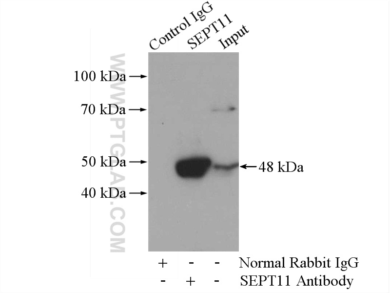 IP experiment of mouse brain using 14672-1-AP