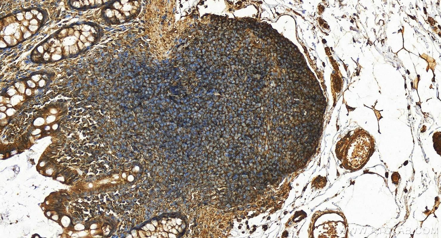 IHC staining of human colon using 11397-1-AP