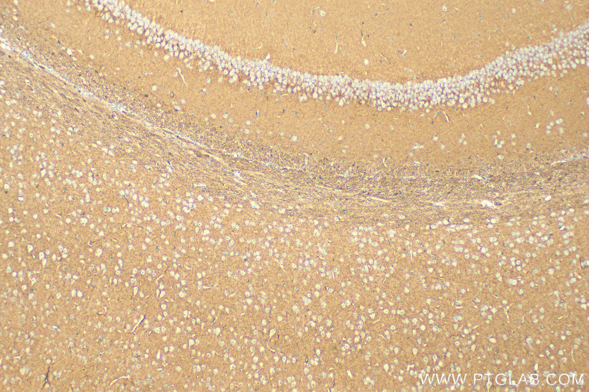 IHC staining of mouse brain using 82284-1-RR (same clone as 82284-1-PBS)