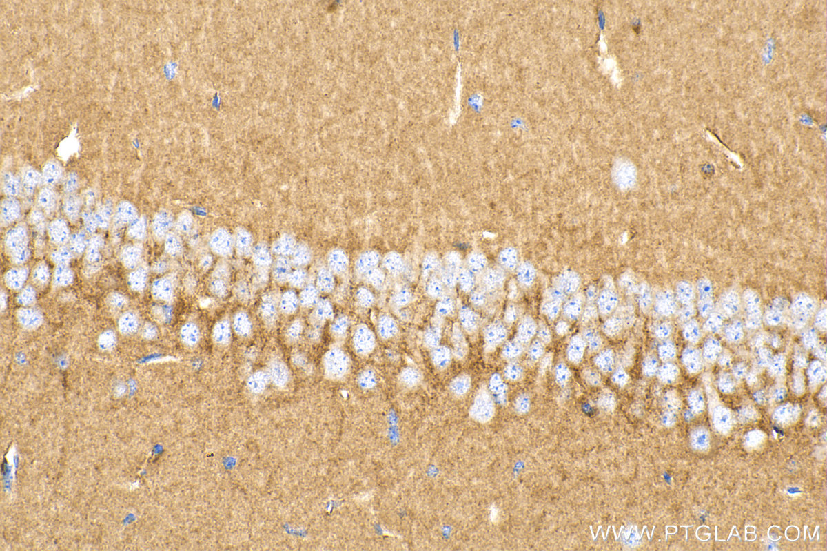 IHC staining of mouse brain using 82284-1-RR (same clone as 82284-1-PBS)