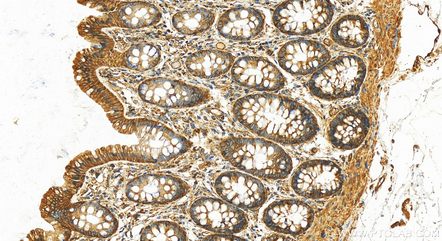 IHC staining of human colon using 10769-1-AP