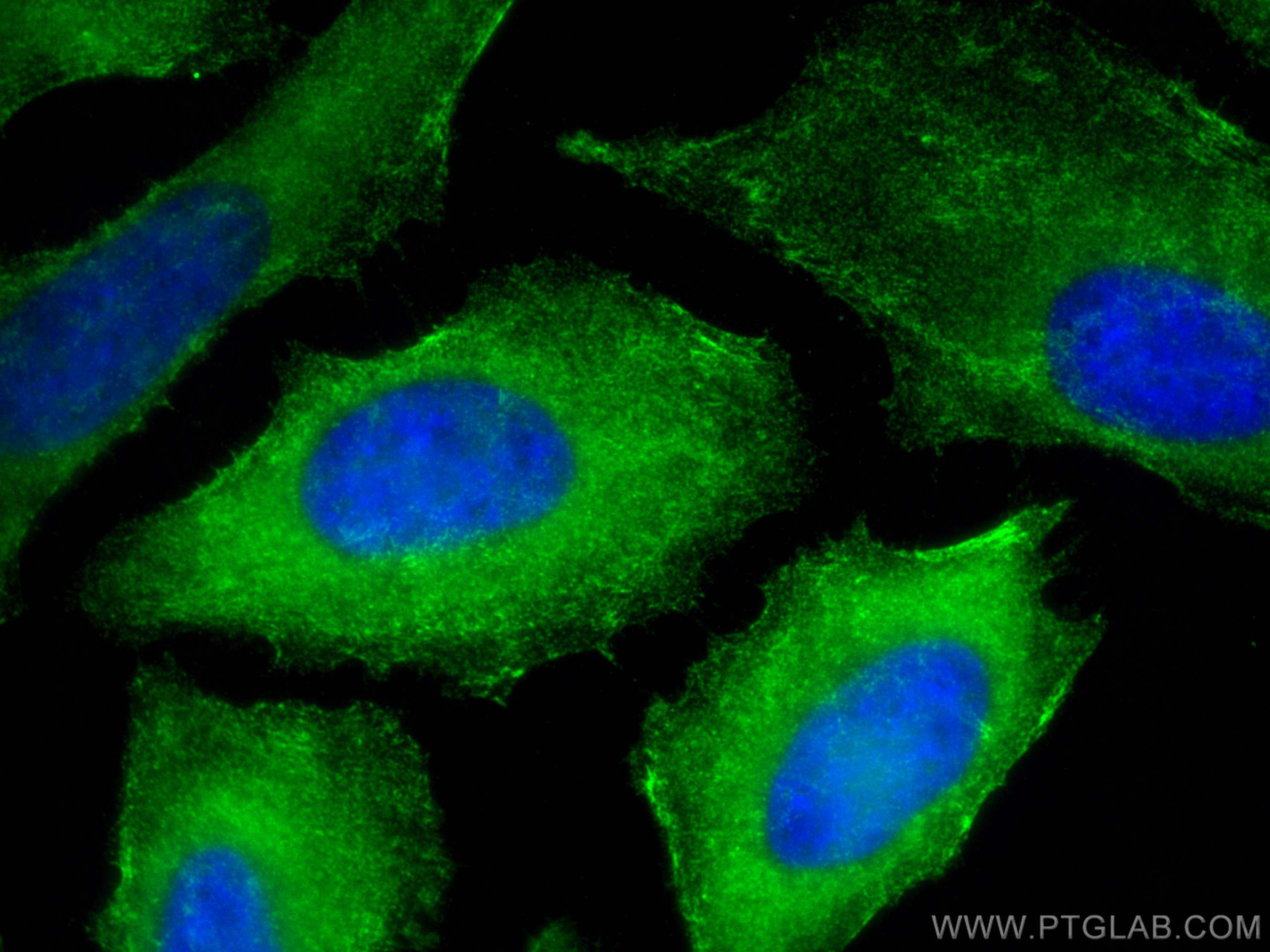 IF Staining of HeLa using 10769-1-AP