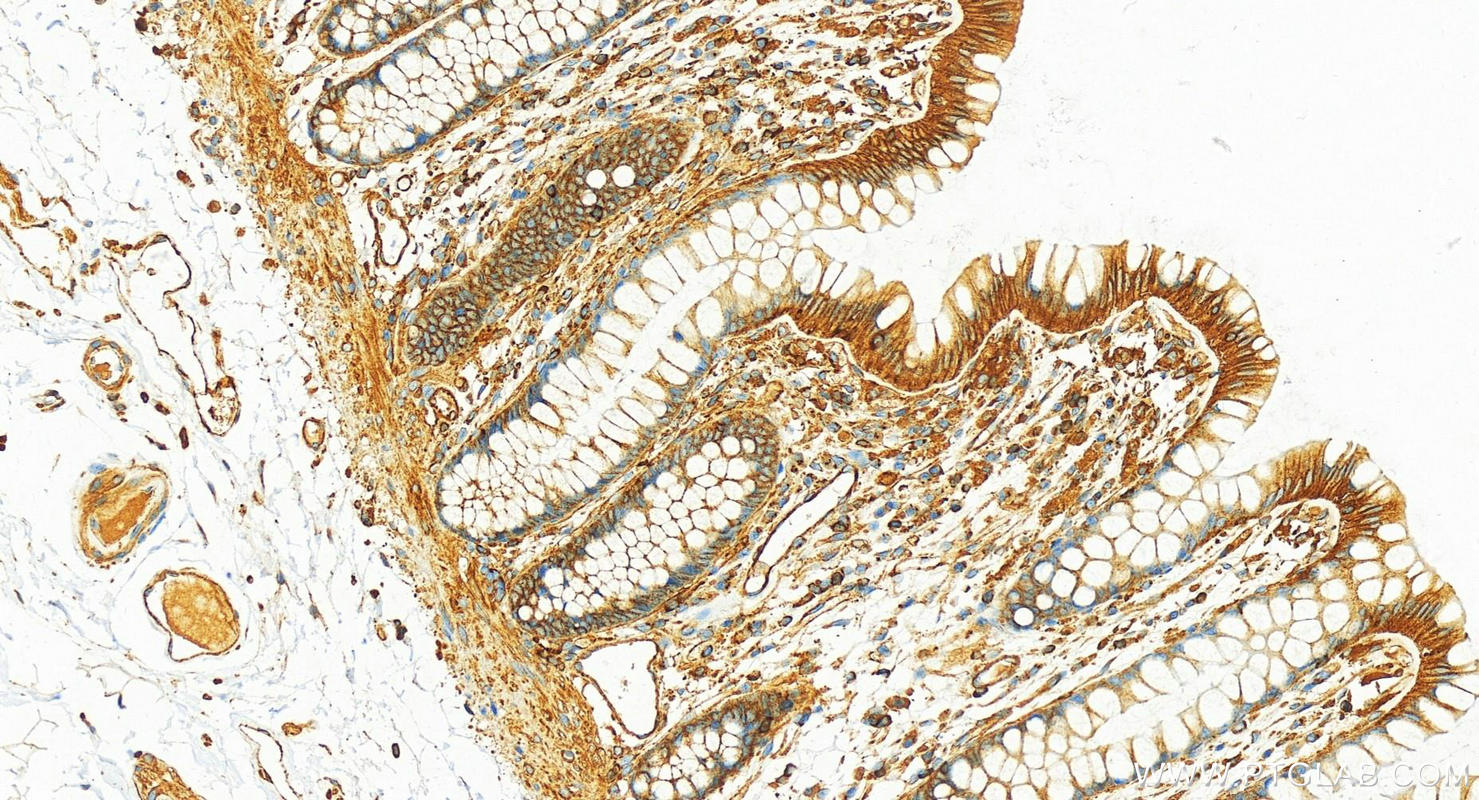 IHC staining of human colon using 82844-2-RR (same clone as 82844-2-PBS)