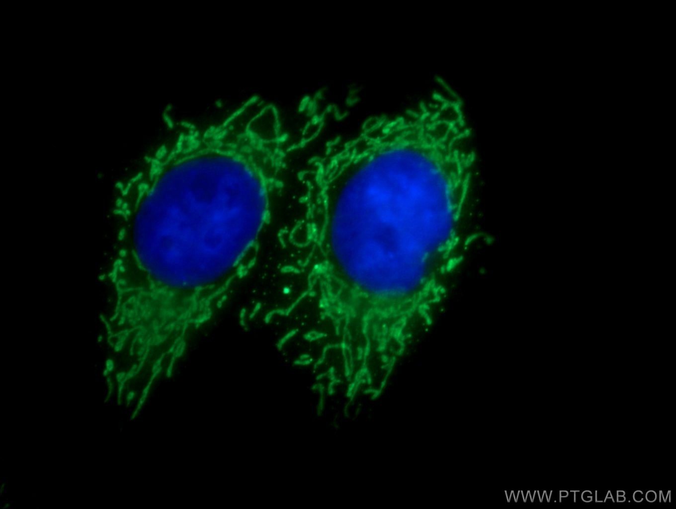 IF Staining of HepG2 using 25729-1-AP