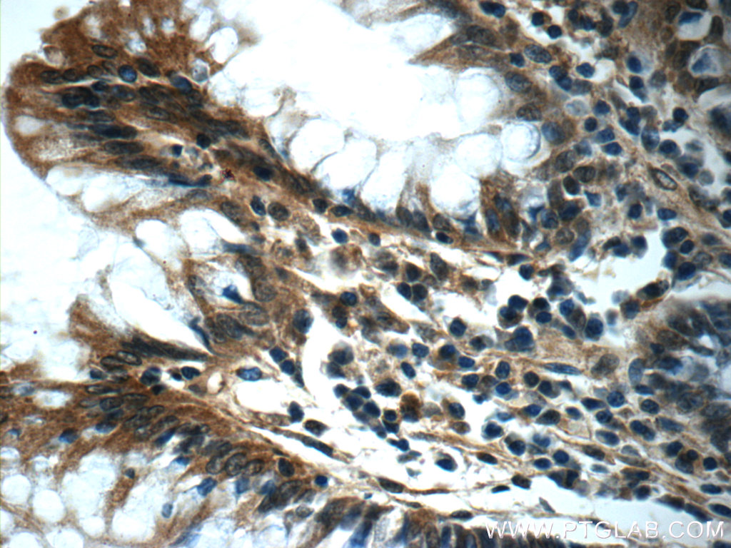 IHC staining of human colon using 25729-1-AP