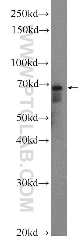 WB analysis of mouse brain using 25729-1-AP