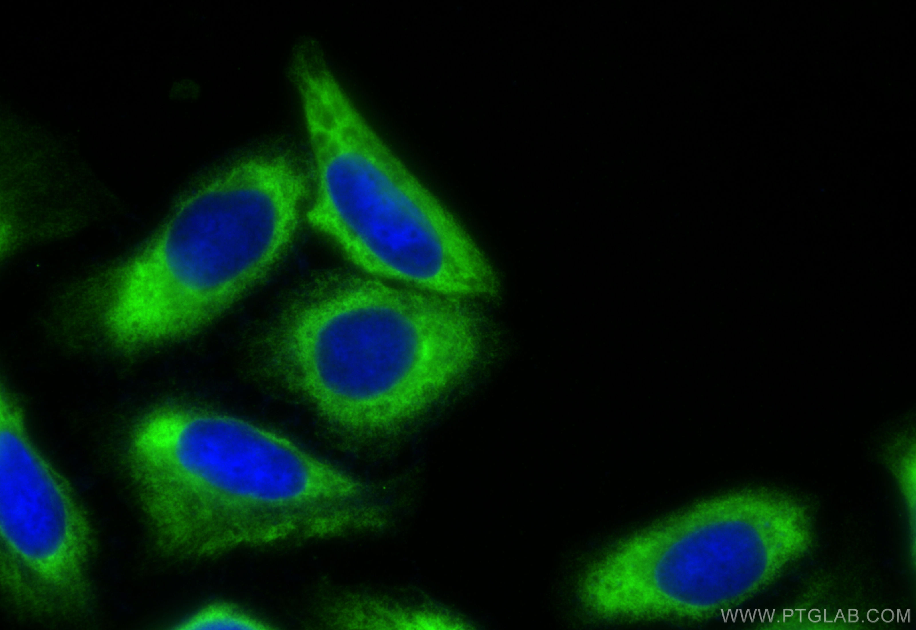 IF Staining of U2OS using 10729-1-AP