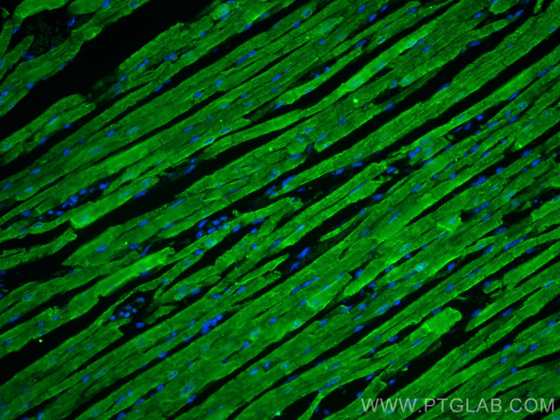 IF Staining of mouse heart using 27311-1-AP