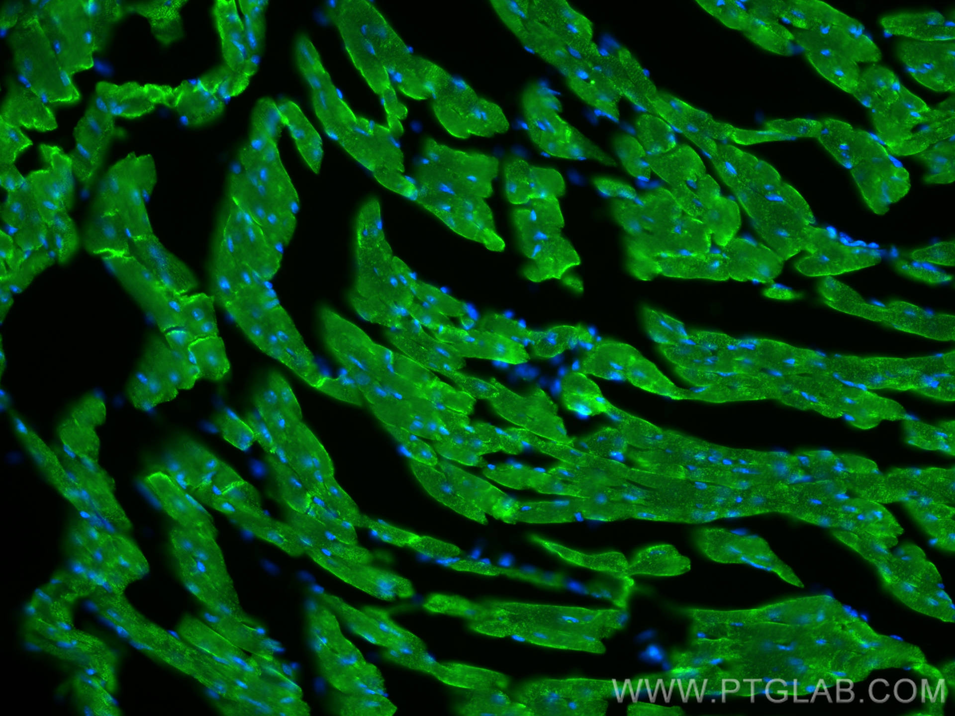 IF Staining of mouse heart using 27311-1-AP