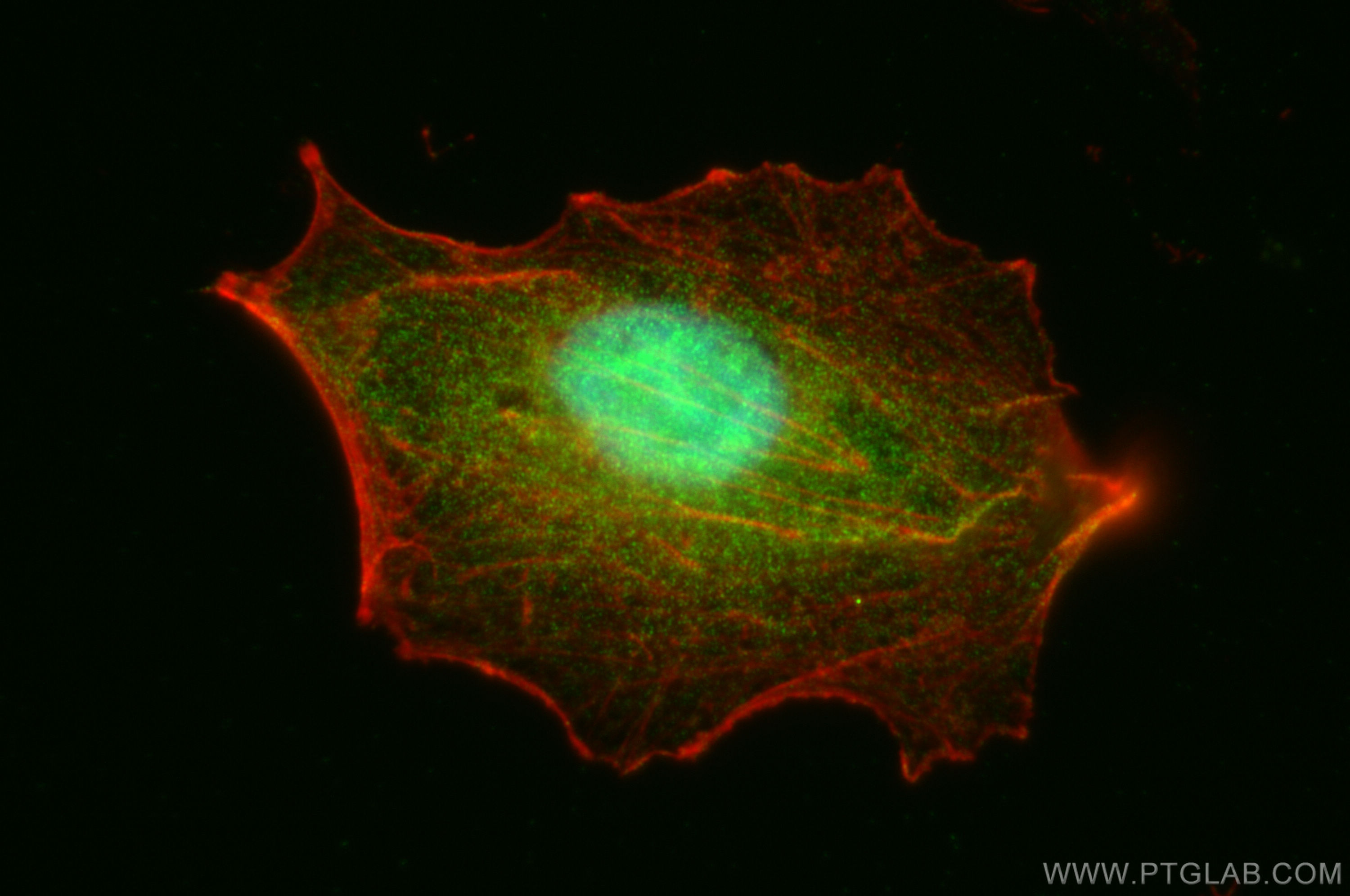 IF Staining of A549 using 11691-1-AP