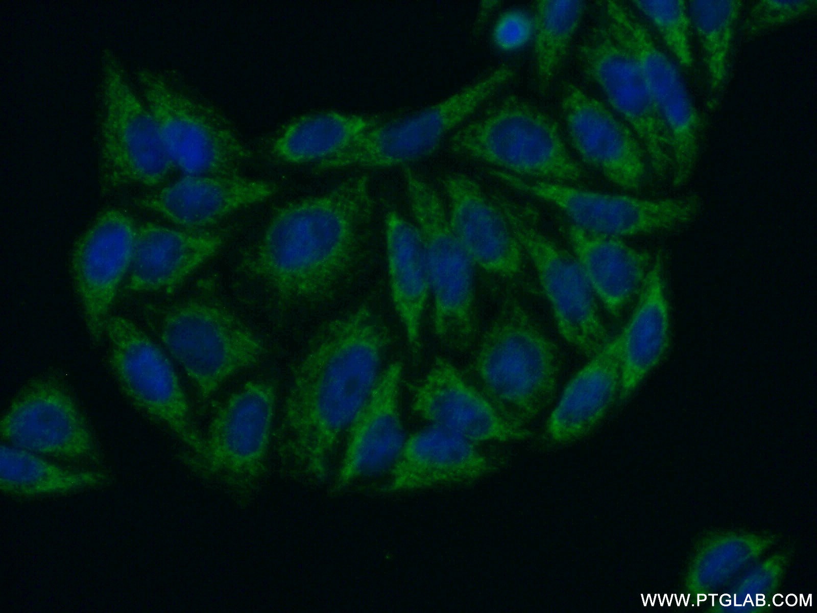 IF Staining of HepG2 using 20265-1-AP