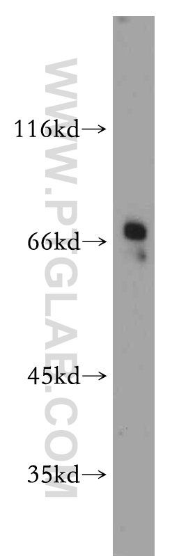 WB analysis of HeLa using 20265-1-AP