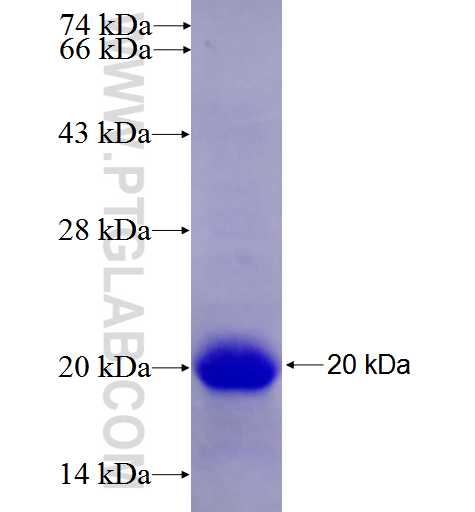 SERINC2 fusion protein Ag26506 SDS-PAGE