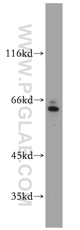 WB analysis of HepG2 using 20266-1-AP